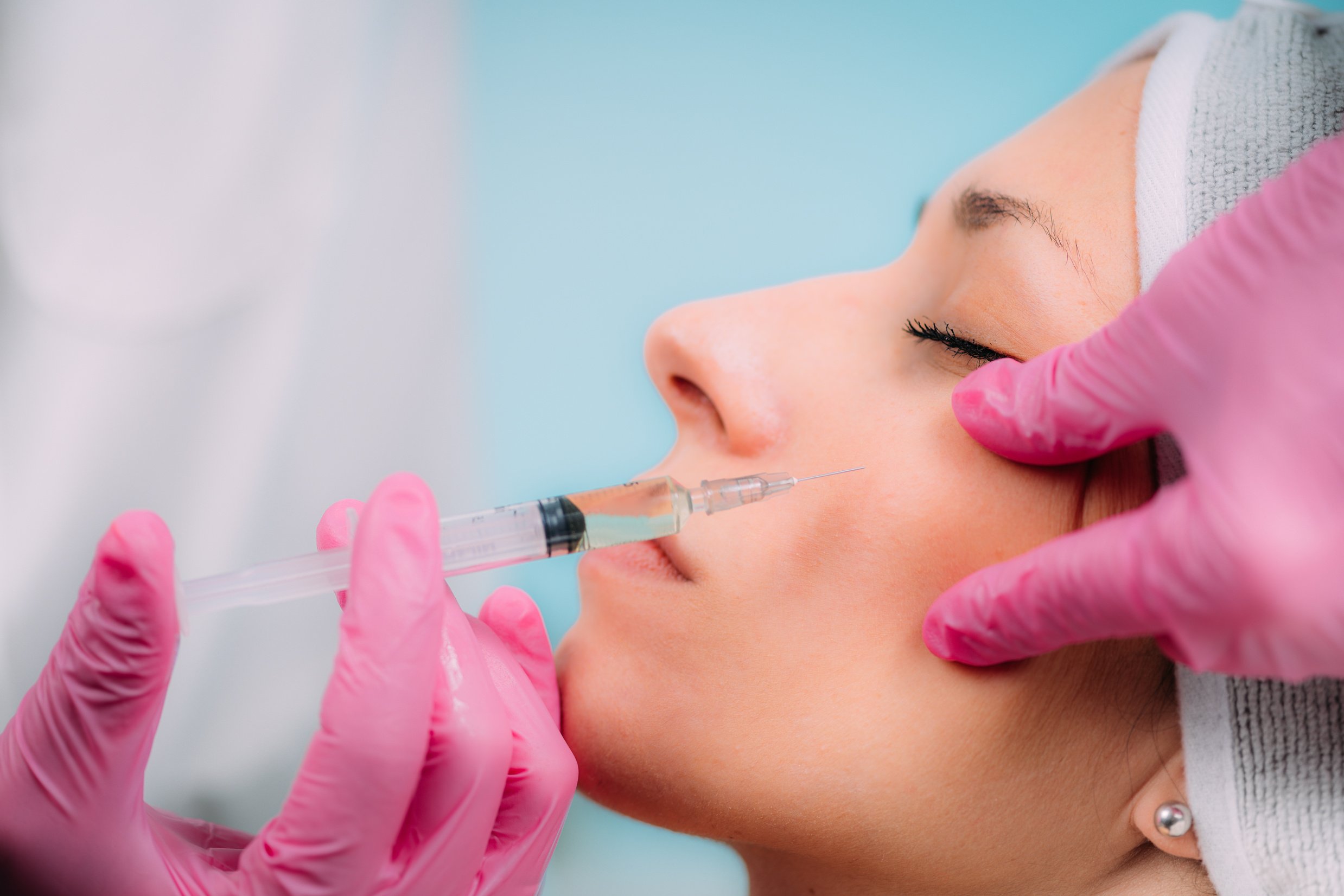 Dermal Filler Injection for Cheeks